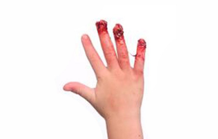 Beware the dangers of closing doors